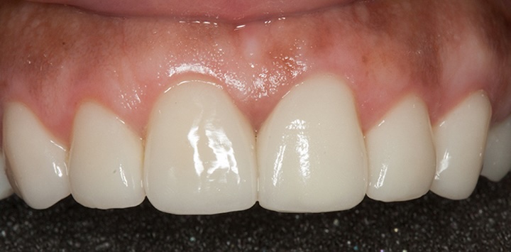 smile gallery image